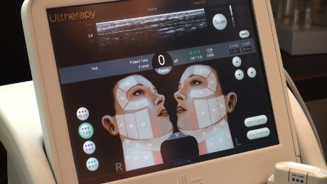 Ultrasound Imaging Ultherapy Device 