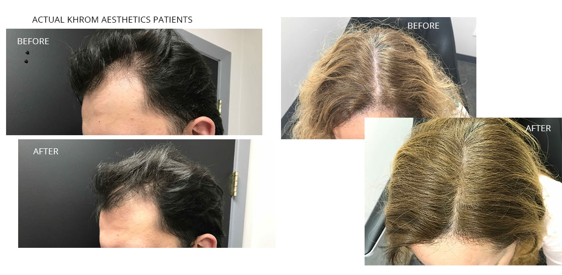 Hair Treatment before and after