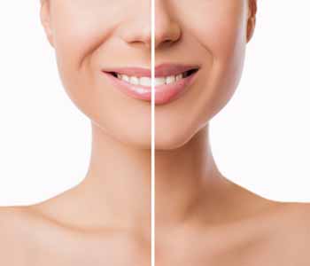 At Khrom Dermatology and Aesthetics, professionals offer patients in and around the Sheepshead Bay, NY area solutions for facial enhancement